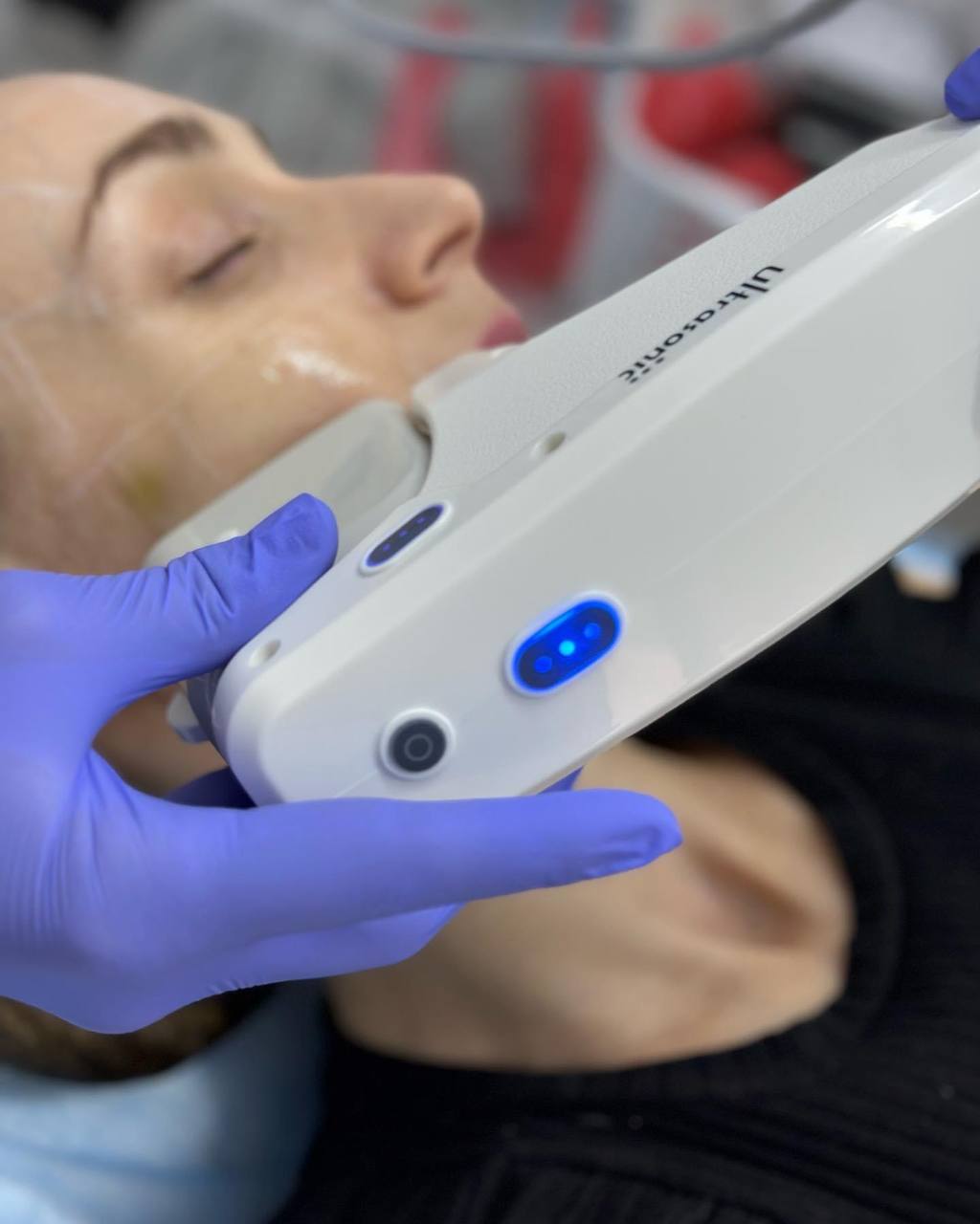 Акционное предложение «Путь к красоте и молодости со SMAS» зображення